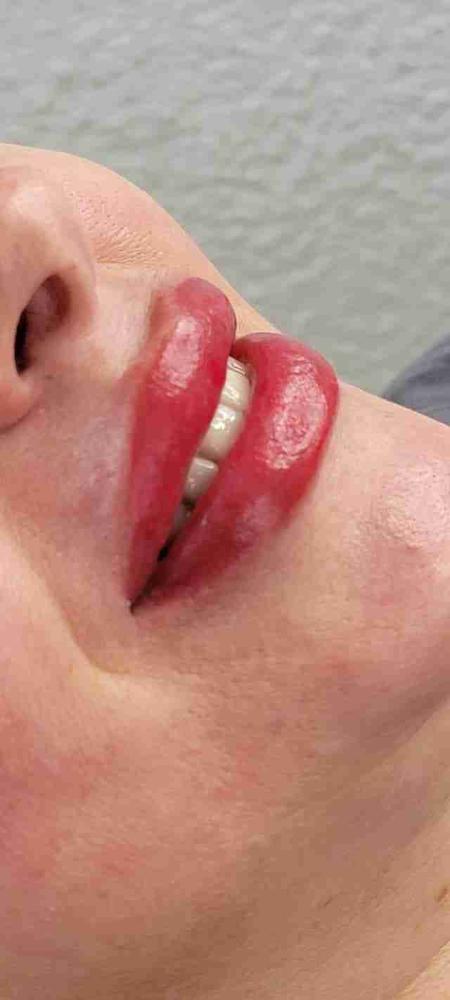 lips 4