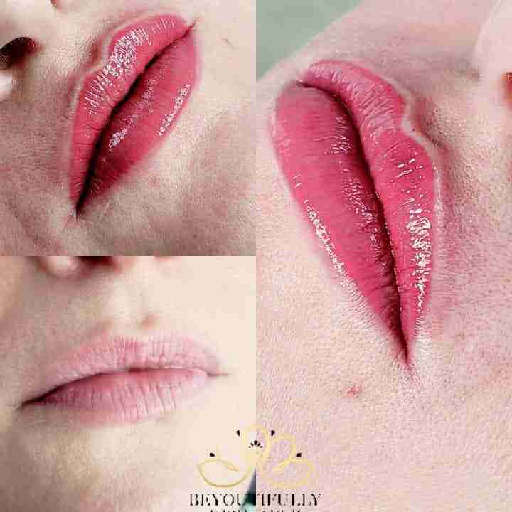 lips 5